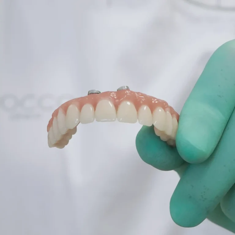 Profissional a segurar uma prótese dentária superior.