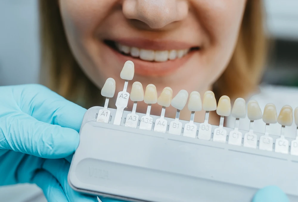 Dentista a mostrar diferentes cores e tons de dentes para tratamento, com sorriso ao fundo.