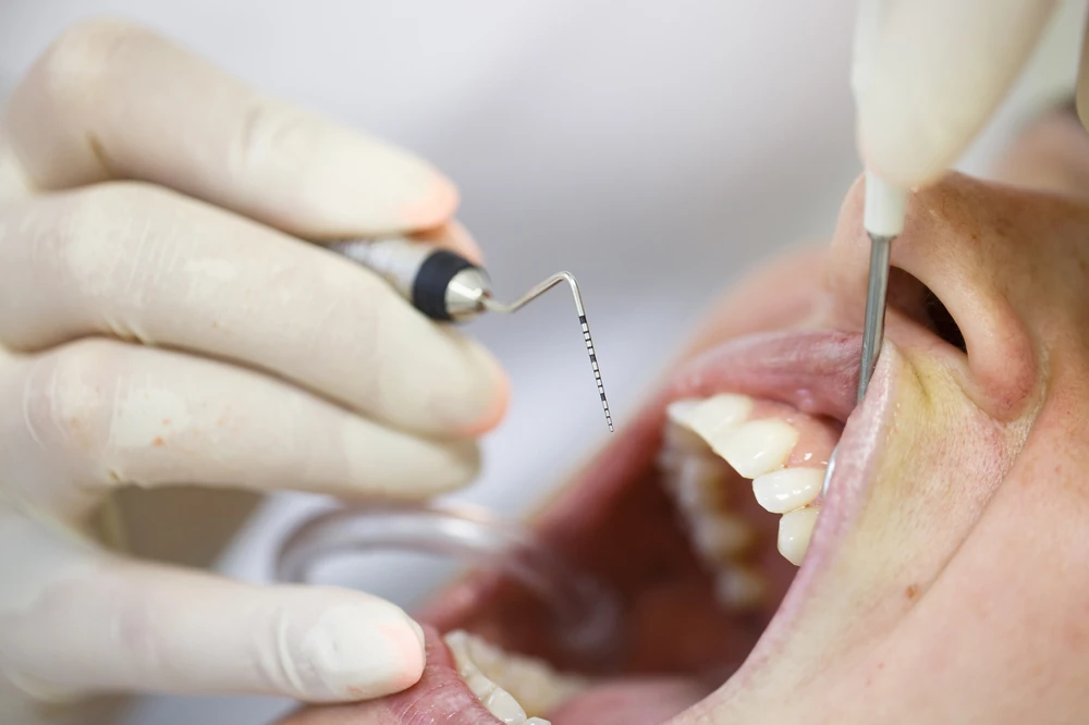 Dentista a realizar procedimento dentário em paciente, uso de instrumento para higiene oral
