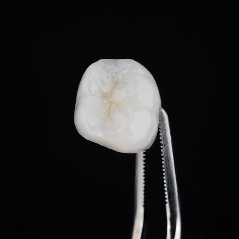 Foco num dente moldado e finalizado.